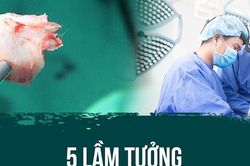5 lầm tưởng về nâng mũi bọc sụn ai cũng gặp phải