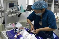 Cứu sống bé sơ sinh bị ngạt khí trong bụng người mẹ đã qua đời