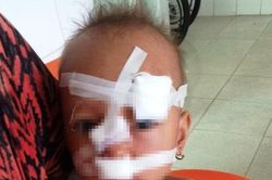 Thực hư thông tin bé 2 tuổi bị bố ném ly trúng mặt, khâu 12 mũi