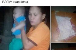 Xác minh thông tin bác sĩ bỏ quên băng gạc trong bụng sản phụ