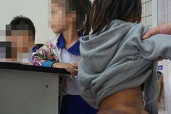 Cà Mau: Bốn học sinh tiểu học nghi bị người thân bạo hành