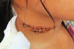 Nữ nhân viên quán ăn bị cứa cổ trong đêm