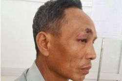 Dân tố bị công an đánh, Trưởng Công an huyện nói gì?