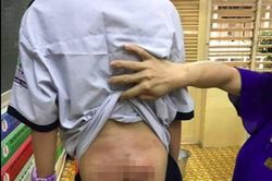 Bé trai 10 tuổi nghi bị bố đẻ và mẹ kế bạo hành, bắt uống nước sôi, ăn phân mèo