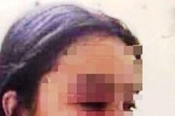 Bộ Y tế yêu cầu xử nghiêm vụ bác sĩ gạ tình, đánh đập nữ điều dưỡng tại Huế
