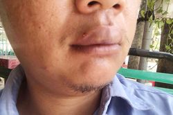 Phóng viên Đài Tiếng nói Việt Nam bị 'người lạ' hành hung trước nhà