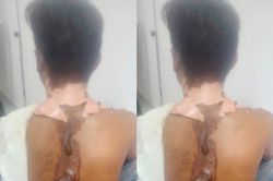 Hé lộ nguyên nhân nam thanh niên bị tạt nước sôi bỏng nặng nhập viện