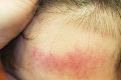 Học sinh ngã sưng đầu, hiệu trưởng bị tố 'phủi' trách nhiệm: Đại diện nhà trường nói gì?