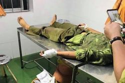 Bắt 5 người trong vụ phá rừng, chém kiểm lâm tại Vườn quốc gia Yok Đôn