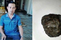 Cận cảnh dị vật trong bụng con dê nuôi 10 năm