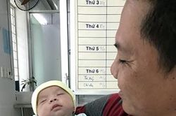 Cứu bé sơ sinh bị teo thực quản nặng
