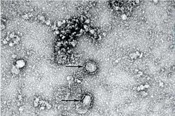 Tiếp xúc trong khoảng cách 2 m có thể lây nhiễm virus corona