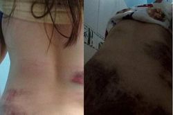 Xác minh, làm rõ vụ người phụ nữ nghi bị chồng bạo hành dã man