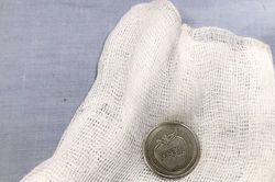 Cứu bé 3 tuổi bị đồng xu mắc chẹn ngang thực quản