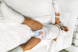 Cứu 2 bé bị bỏng nặng trong vụ ném 'bom xăng' ở Bình Dương