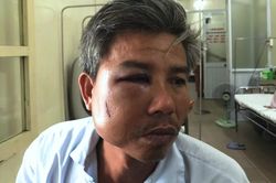 Nhân viên cây xanh bị đánh bầm dập, vỡ hàm khi chụp ảnh hiện trường
