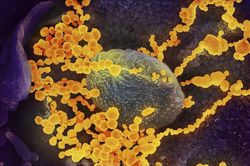 Nhật Bản cho phép xét nghiệm virus SARS-CoV-2 qua nước bọt