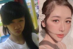 Chia tay vì bị chê bai ngoại hình, cô gái 21 tuổi 'lột xác' nhờ phẫu thuật thẩm mỹ
