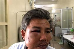 Khởi tố đối tượng đánh vỡ xương hàm nhân viên Trung tâm công viên cây xanh