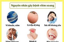 Phòng tránh bệnh viêm mũi xoang mùa hè