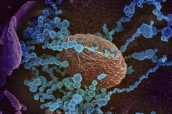 Phát hiện dấu ấn sinh học hỗ trợ đánh giá hiệu quả của vaccine ngừa COVID-19