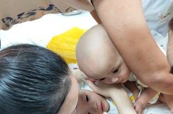 Chính thức vào ca mổ kéo dài 12 tiếng tách hai bé song sinh dính nhau hiếm gặp