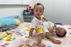 Ca song sinh dính liền: 'Xin tạo hóa sinh 2 con lần nữa với nguyên vẹn hình hài'