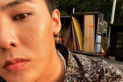 G-Dragon lộ làn da nhiều mụn