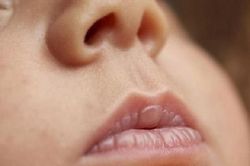 Vì sao trẻ khô môi, khắc phục thế nào?