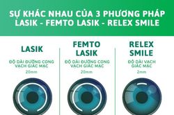 Hỏi đáp xoay quanh các phương pháp phẫu thuật laser: Xóa cận-viễn-loạn phổ biến hiện nay (kỳ 1)