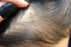 Trung Quốc: Giáo viên mầm non ngược đãi, đâm kim vào đầu và người trẻ