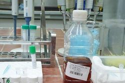 Người đàn ông 32 tuổi tử vong sau bữa nhậu với rượu, thịt chó