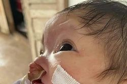 Em bé nhiều khiếm khuyết