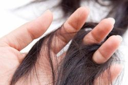 Nôn ói liên tục, bé gái 8 tuổi khiến bác sĩ 'sốc' khi thấy thứ này trong ruột