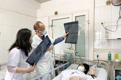 Một phụ nữ bị mù mắt sau khi tiêm chất nâng mũi để làm đẹp