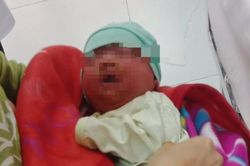 Trẻ dị ứng nặng sau khi được tắm bằng lá cây