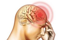 Chấn thương sọ não và Alzheimer gây suy giảm nhận thức tương tự nhau