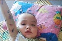 Xót xa cháu nhỏ bị bệnh hành hạ