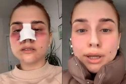 Cô gái khoe video thành hotgirl nhờ sửa mũi, netizen soi ra điểm vô lý