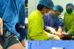 120 phút phẫu thuật cứu sống bệnh nhân bị cọc bần đâm xuyên hạ vị