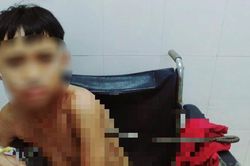 Bé trai bị thanh sắt đâm thấu ngực trong lúc chơi đùa
