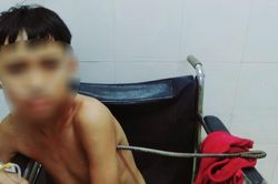 Cứu sống bệnh nhi bị thanh thép đâm xuyên ngực