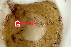Hãi hùng giun sán lúc nhúc trong nước sinh hoạt ở Hà Nội