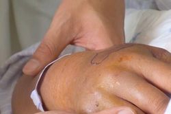 Đắp thuốc lá khi bị rắn cắn, bé trai 13 tuổi tử vong thương tâm