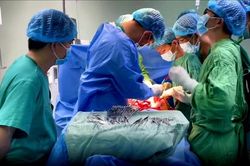 Cứu sống bệnh nhân xuất huyết tiêu hóa trên do rò động mạch hiếm găp