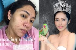 Nghị lực như Hoa hậu Đặng Thu Thảo: Từ nhan sắc bị mụn tàn phá khi mang bầu đến bản lĩnh trước đổ vỡ hôn