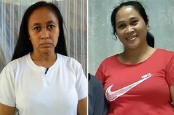 Hội chứng khiến cô gái 16 tuổi già hơn cả mẹ