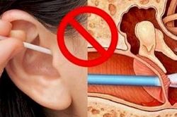 Phát hiện khối u ác tính sau nhiều năm vệ sinh tai sai cách, chuyên gia cảnh báo từ bỏ ngay sai lầm này