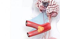 Đời sống Đời sống Phòng ngừa tai biến, bảo vệ sức khỏe tốt hơn!