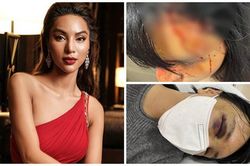 Siêu mẫu Khả Trang tung loạt ảnh bị bạo hành dã man
